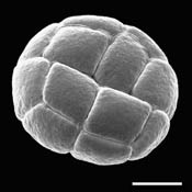 Pollen Grain S.E.M - <em> Acacia berlandieri</em> - Guajillo