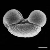 Pollen Grain S.E.M - <em> Pinus echinata</em> - Shortleaf pine