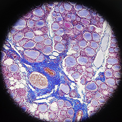 Extracellular matrix