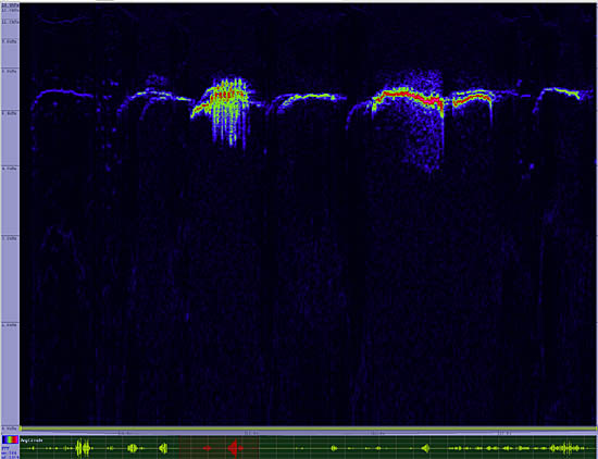 bird sonogram