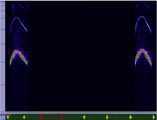 bird sonogram