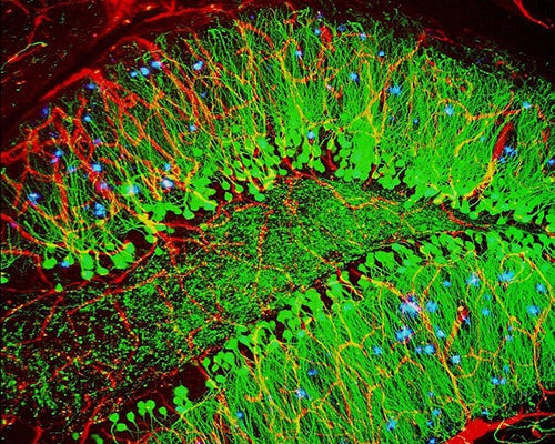 colorized mouse brain tissue (green) showing protein plaques (blue)