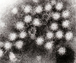 norovirus