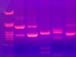 Gel electrophoresis