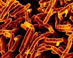 Mycobacterium tuberculosis