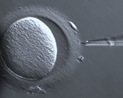 Oocyte being injected