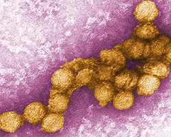 A microscope image of a many virus particles from the family Flaviviridae