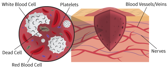 wound healing image 1