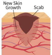 wound healing image 2