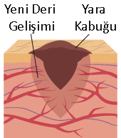 wound healing image 2