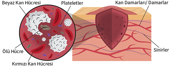 wound healing turkish