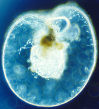 Noctiluca scintillans through a microscope