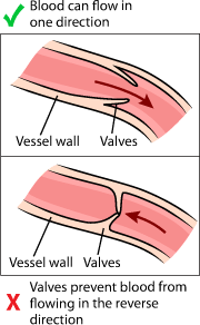 valves