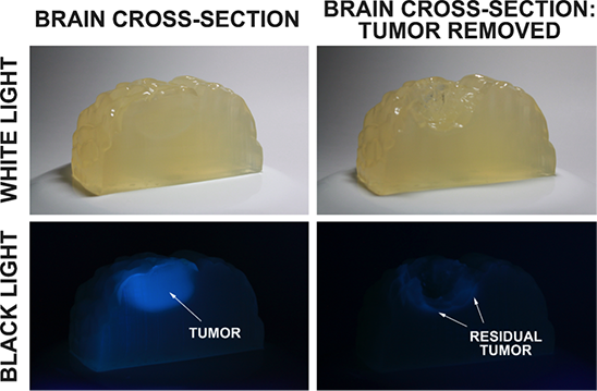 Gelatin brain cross section