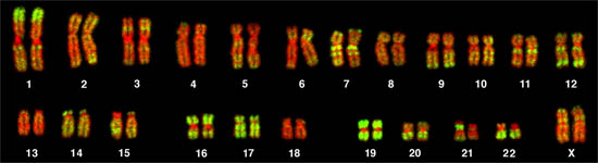 Human Female Chromosomes