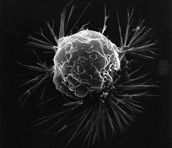 breast cancer cell