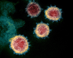 A microscopic view of SARS-Cov-2, the virus that causes the coronavirus.