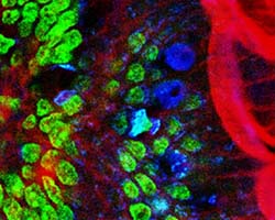 Fluorescent tissues from mouse intestines