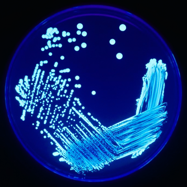 Picture of Legionella bacteria on an agar plate with ultraviolet light.