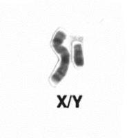 Male sex chromosomes, XY