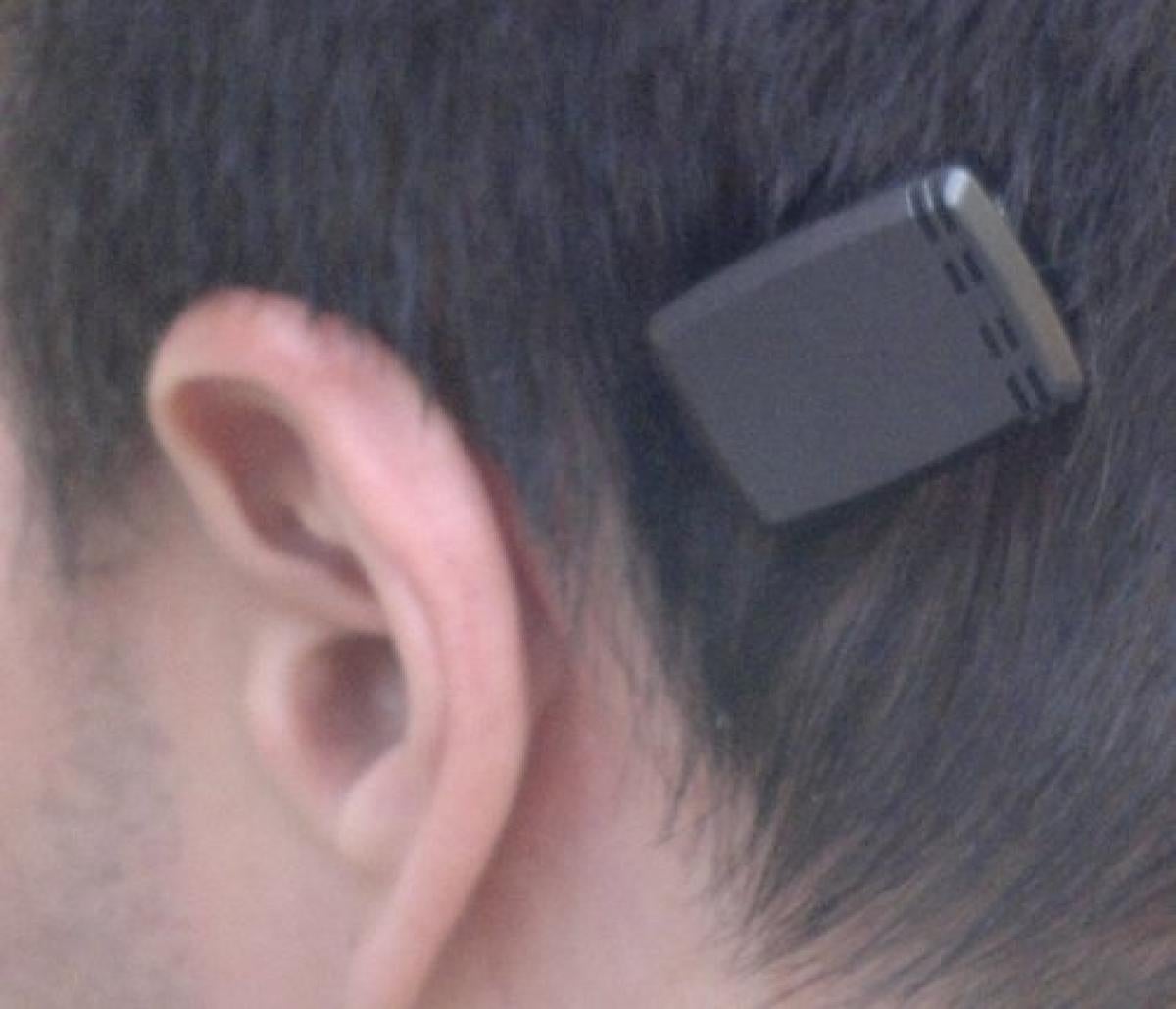 Bone-anchored hearing device