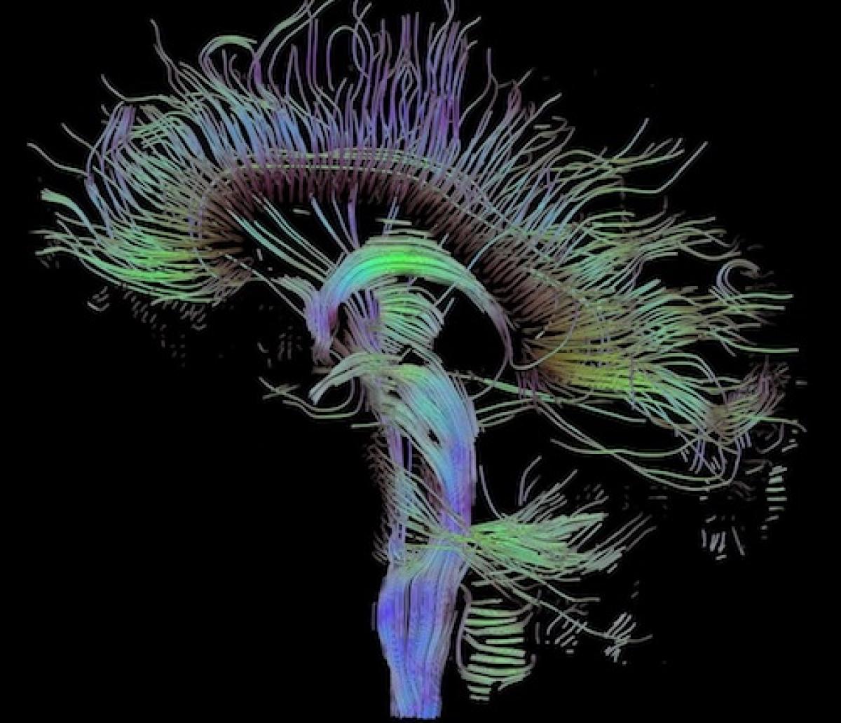 Brain fiber tracts shown in green and purple colors