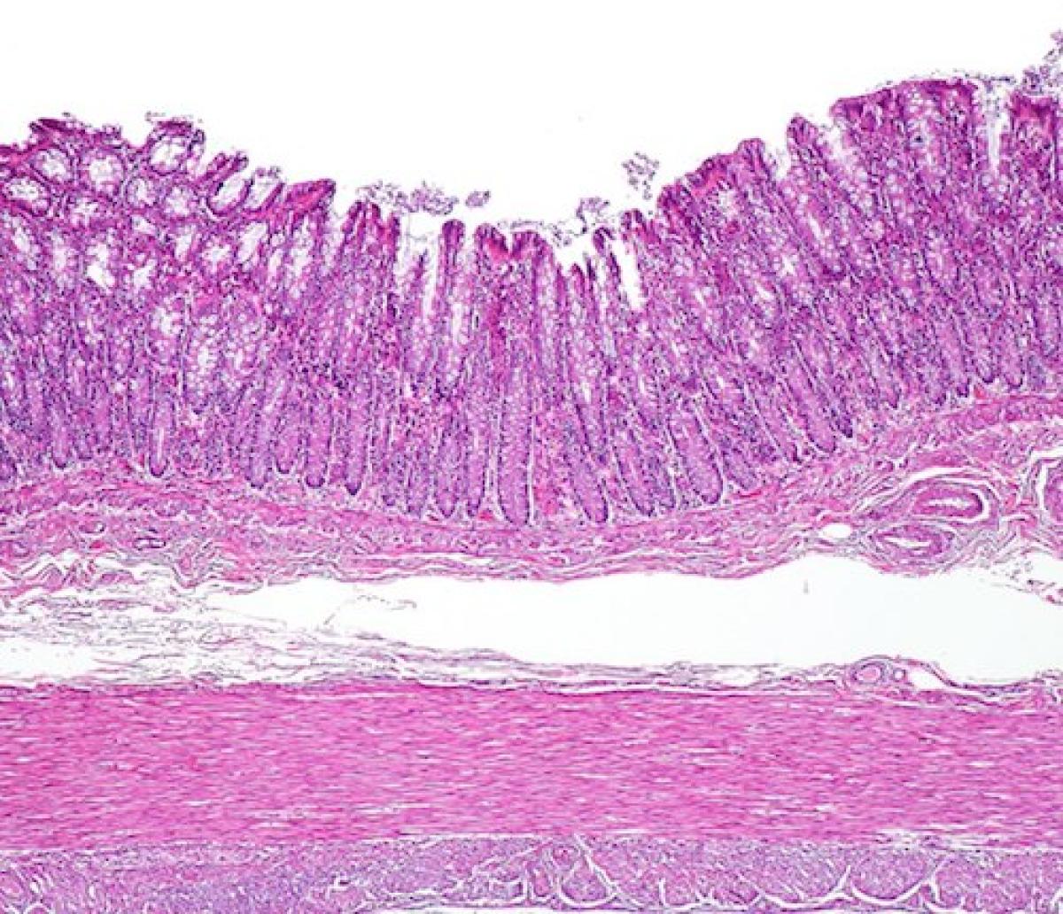 Colon histology