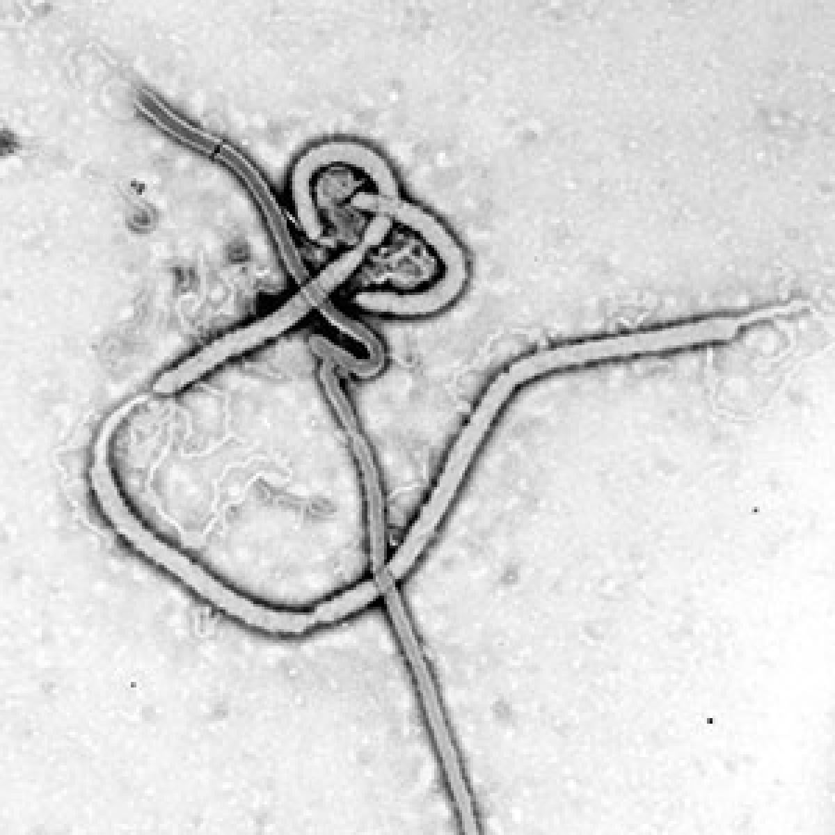 Ebola virus particles