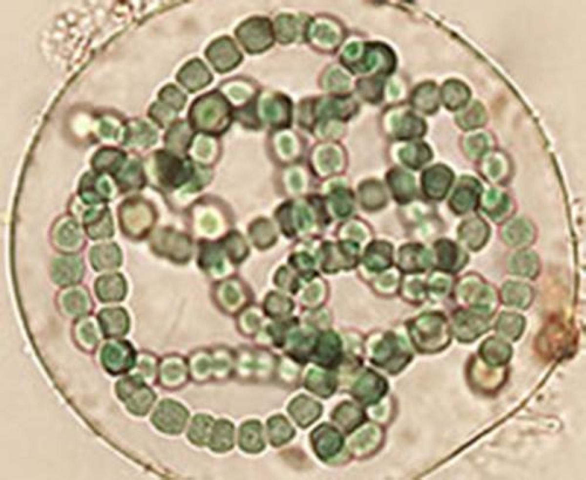 Cianobacterias filamentosas