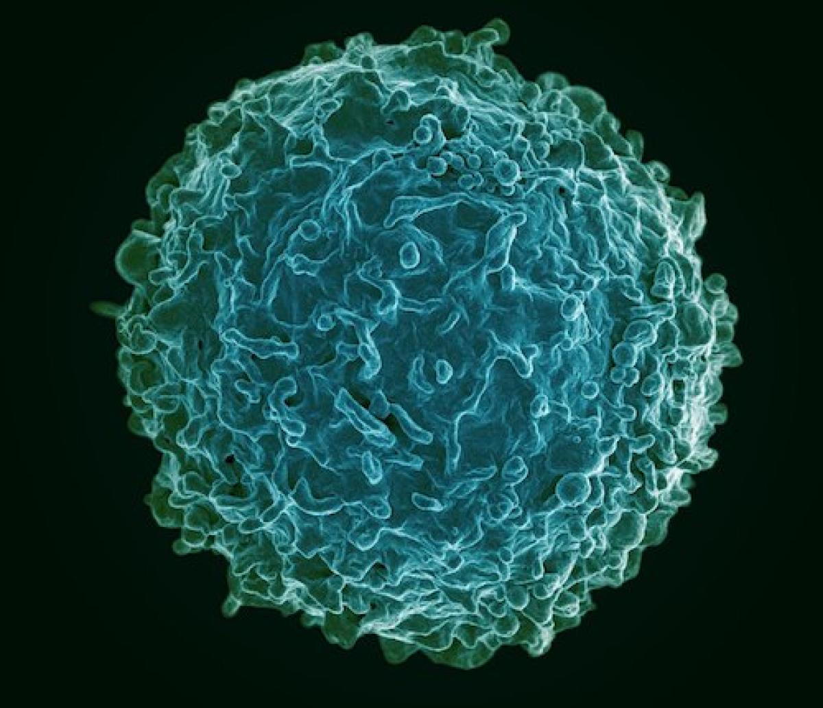 Human B lymphocyte image, colored to be green blue