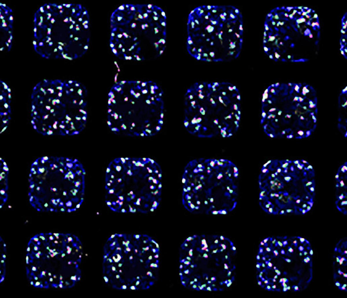 glowing kidney cells grown in a lab