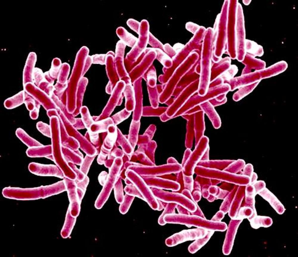 Mycobacterium tuberculosis, the bacteria that causes tuberculosis