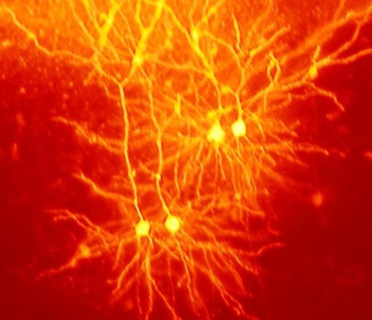 An image of a neuron