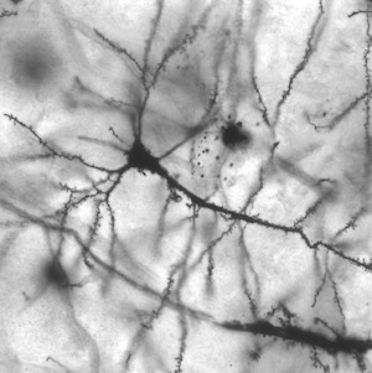 Hippocampal neuron