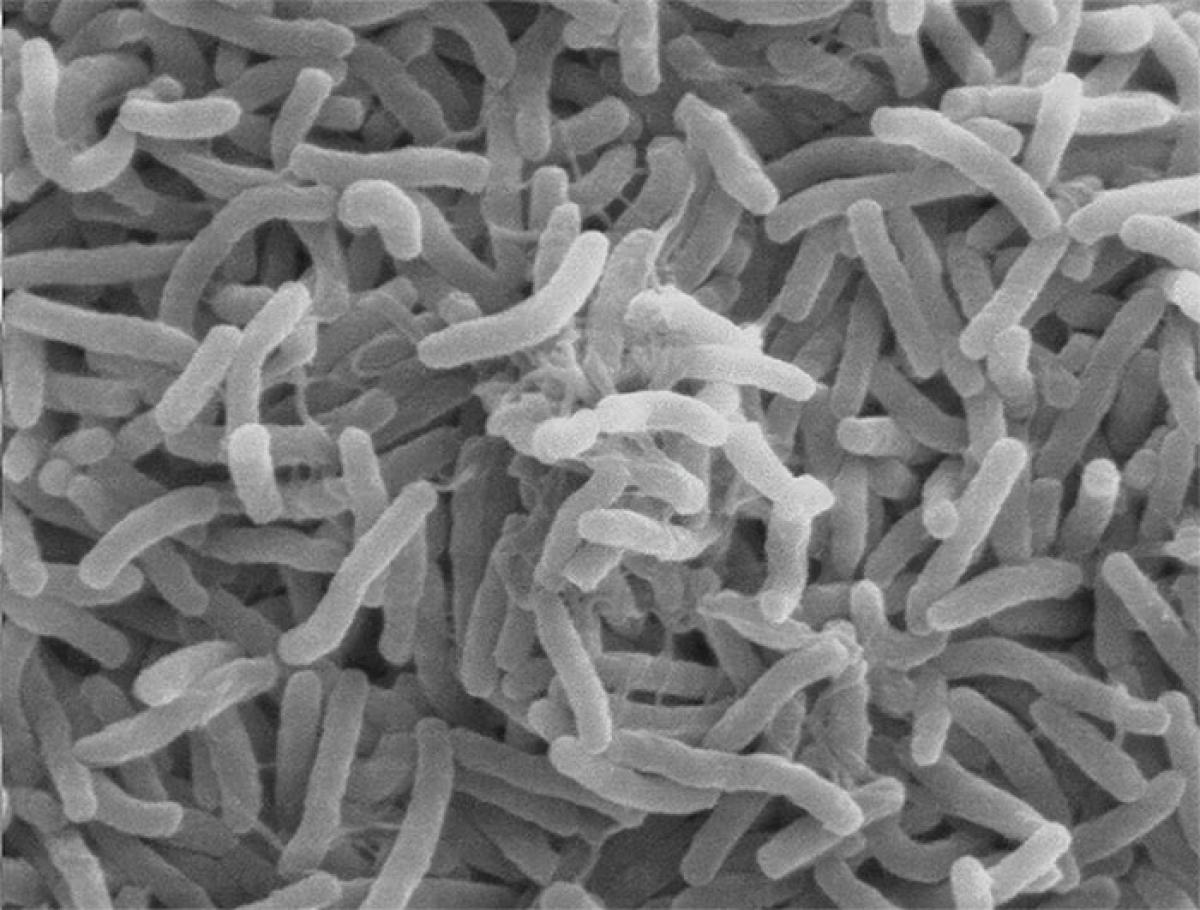 Microscope image of vibrio cholerae bacteria